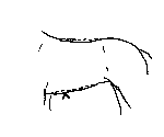 17.gif