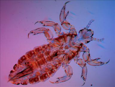 louse.jpg
