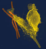 007-Neutrophil_with_anthrax.jpg